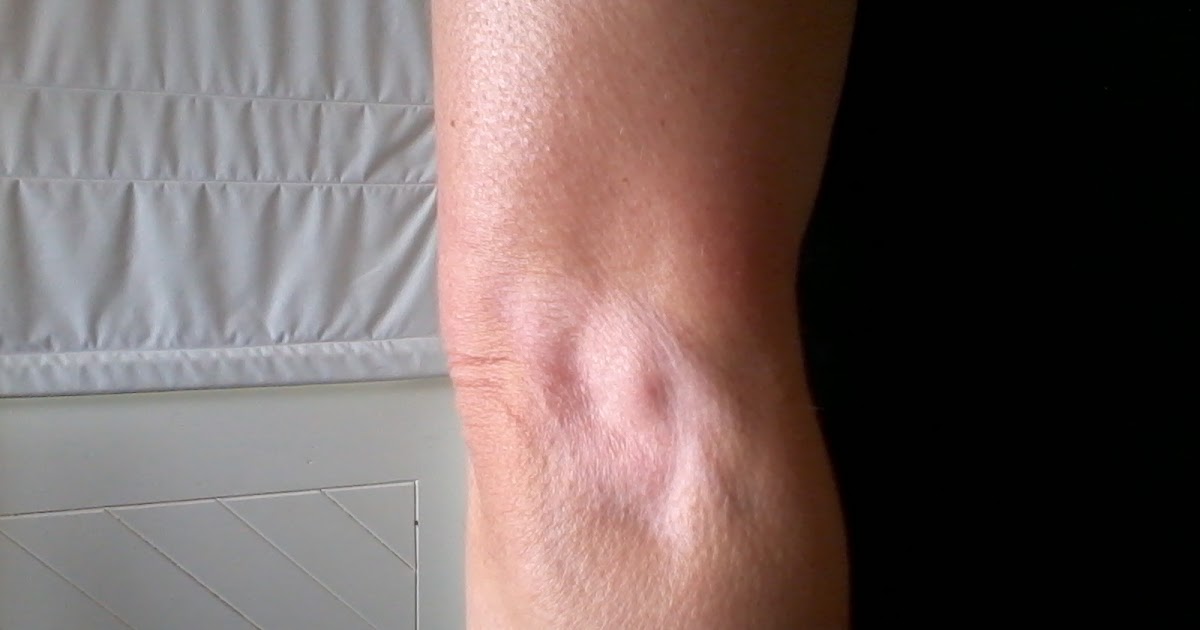 Health, Fitness Naturally! Even more warnings about