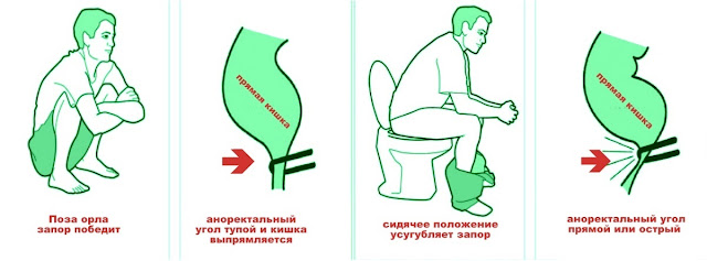 Здоровая дефекация (опорожнение): биомеханика и психология Здоровая дефекация (опорожнение): биомеханика и психология