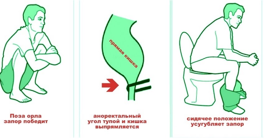 Что категорически нельзя беременным из еды 97