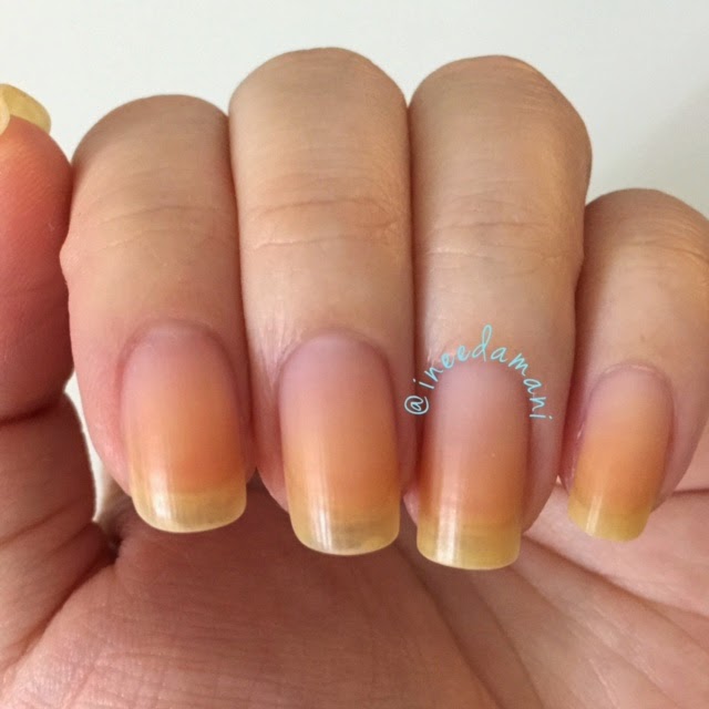 Why Are Nails Yellow After Removing Polish at Clarence Amato blog