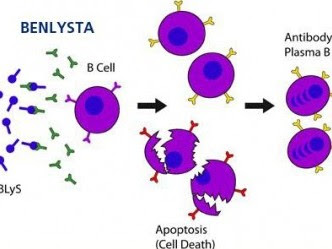 LUPUS ERITEMATOSO TRATAMIENTO lupus eritematoso tratamiento: