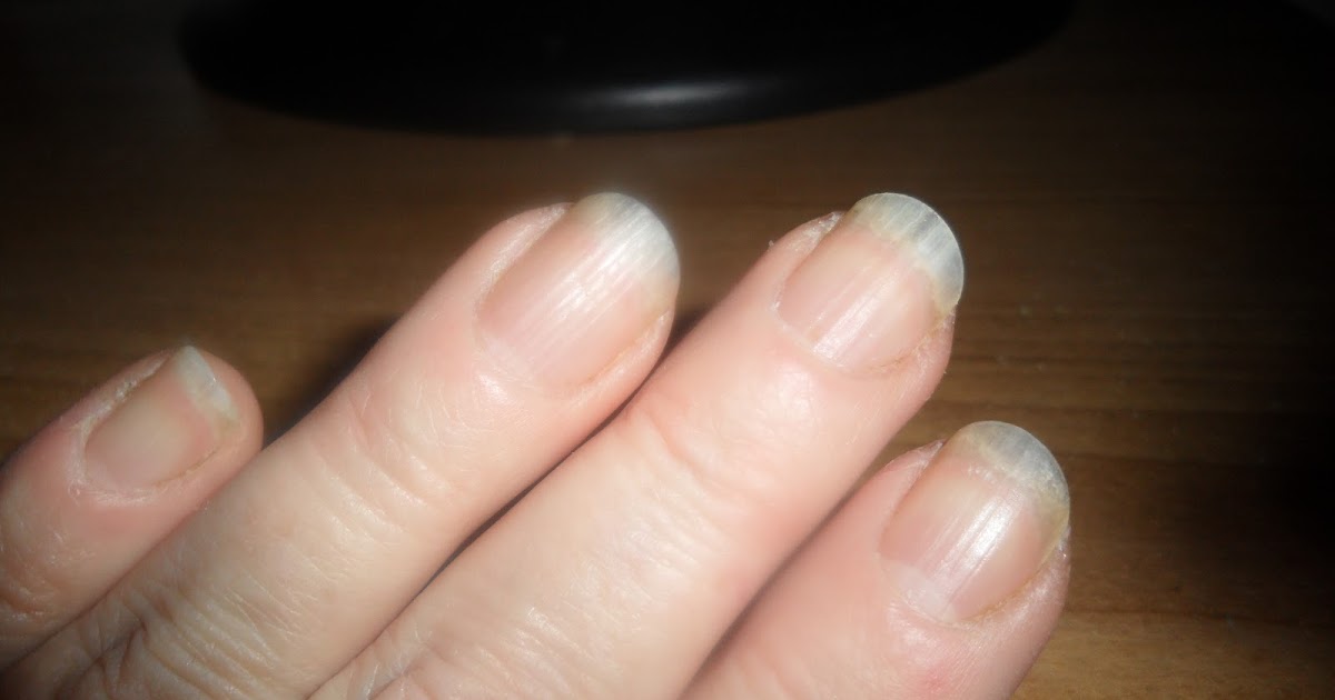 Beauty Blog by Lisa TIPS from head to toe! From acrylic damaged