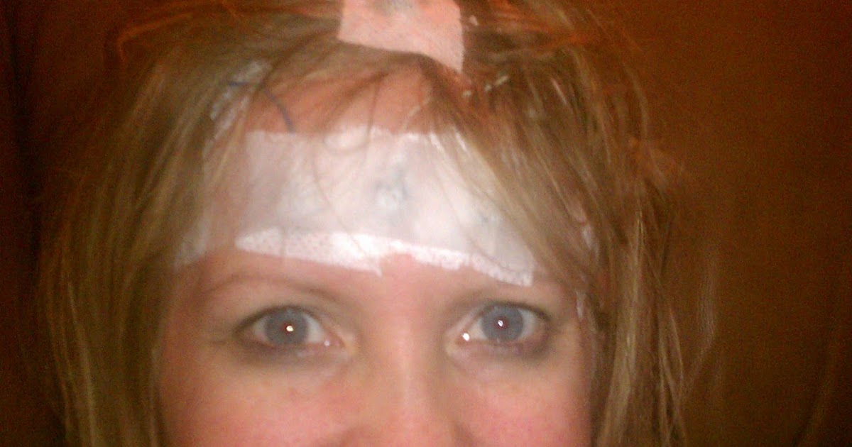 72 hour eeg 72 hour eeg