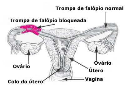 Ciclo menstrual irregular: como identificar o período fértil?, Dr. Augusto  Bussab