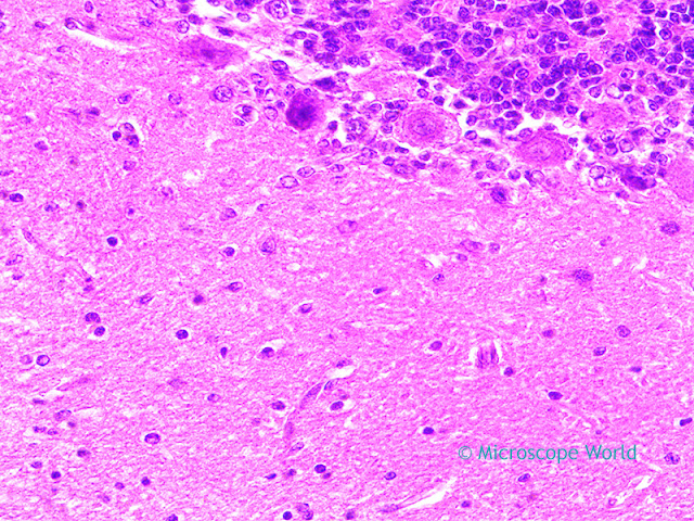 Cerebellum image under the microscope at 400x. Microscopy image of the cerebellum captured at 400x by Microscope World.