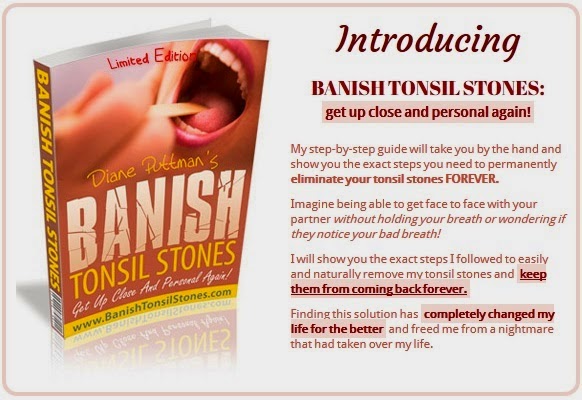 Banish tonsil stones