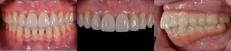 Dental Photography Pearls For Better Images Instantly