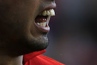 Luis Suarez dentadura