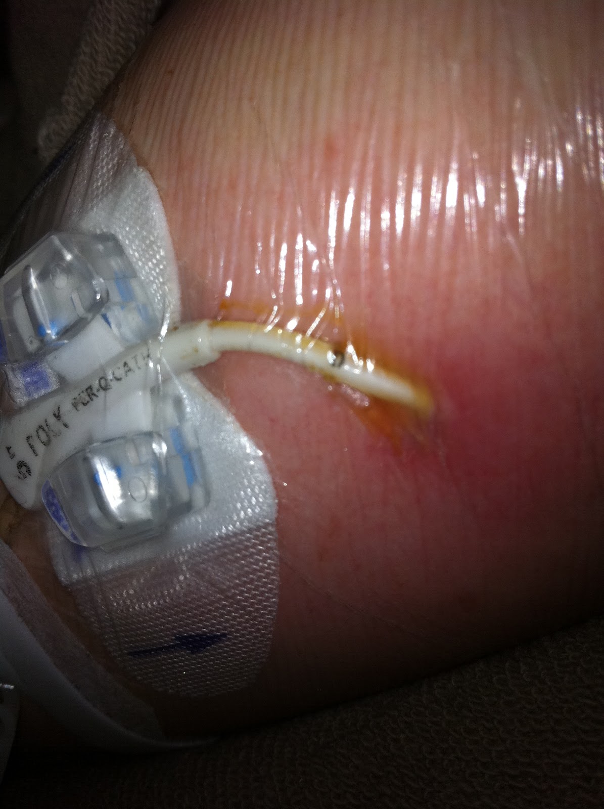 Let me out... I'll stomp on it! Bye Bye PICC