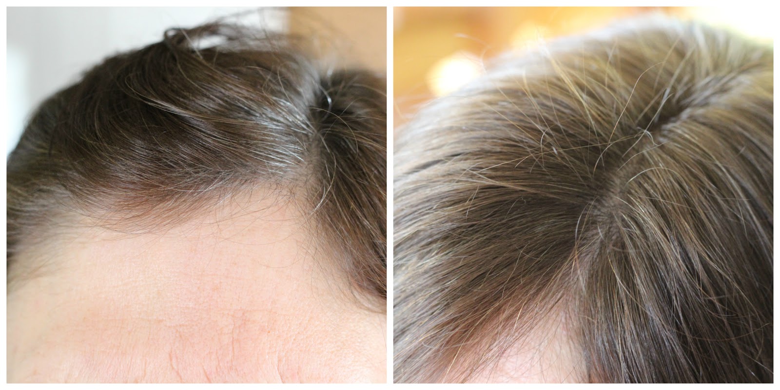 Vidal Sassoon Salonist Hair Colour Vidal Sassoon Salonist Hair Colour