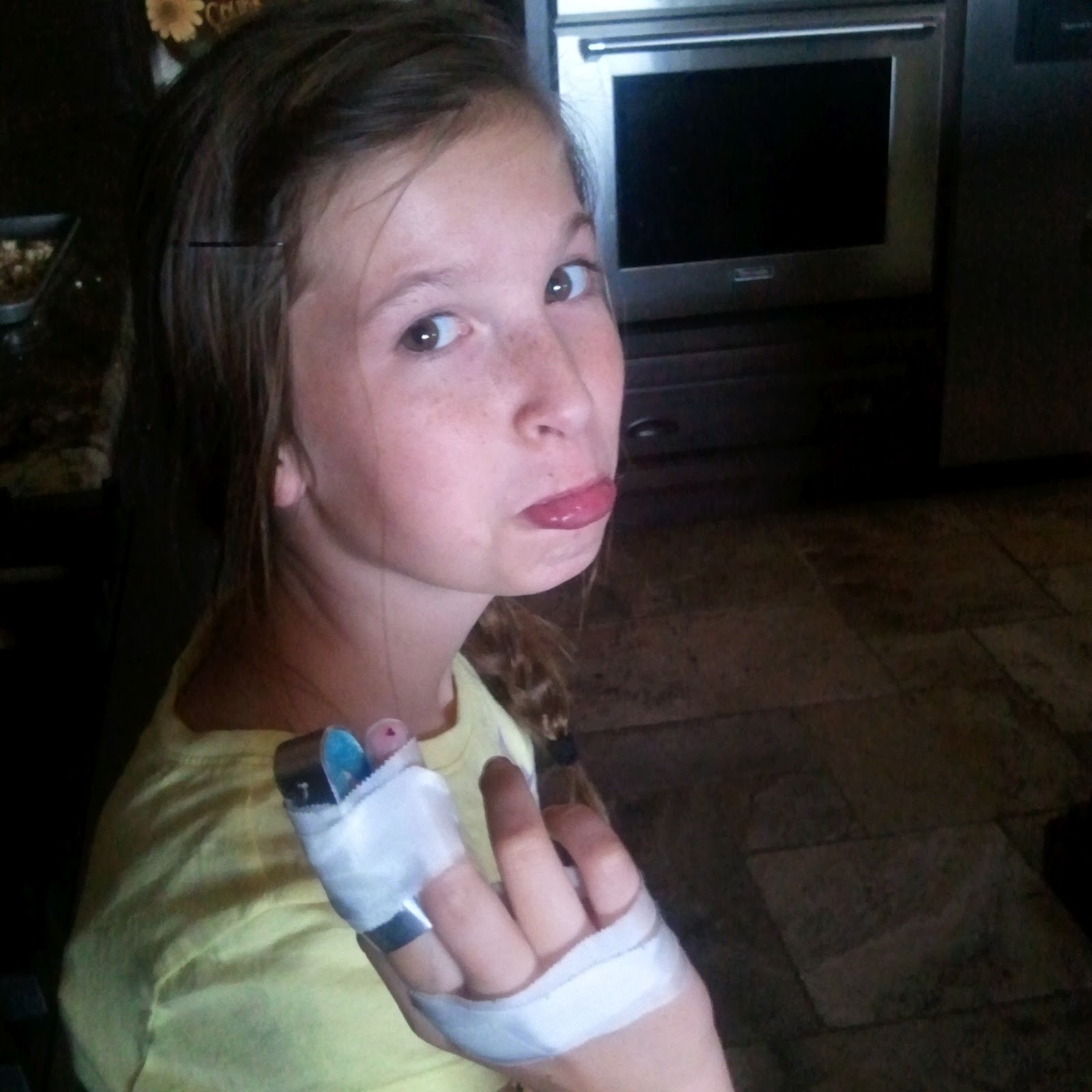 Broken Finger Surgery