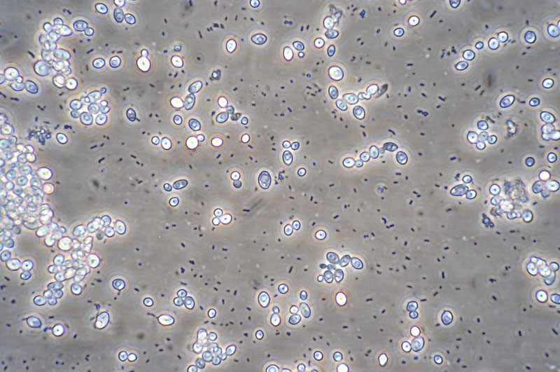 Brew by Brew Wild Yeast Microscopy