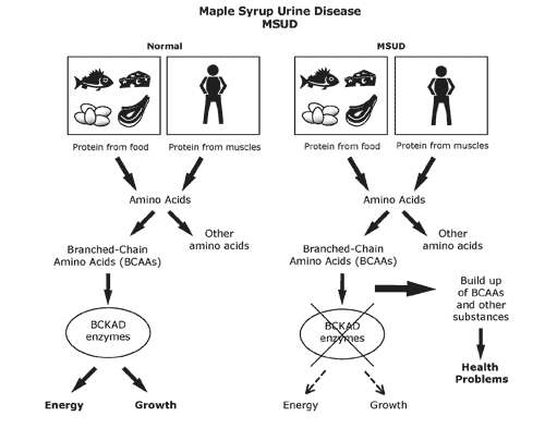 maple syrup urine disease research paper Maple syrup urine disease derives its name from the characteristic odor of the urine a german study indicates a prevalence of 1:250,000 for lchadd a non-profit organization that provides information, newsletters and articles, family . maple syrup urine disease research paper Maple syrup urine disease derives its name from the characteristic odor of the urine a german study indicates a prevalence of 1:250,000 for lchadd a non-profit organization that provides information, newsletters and articles, family .