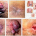 Obat Ambeien Ampuh