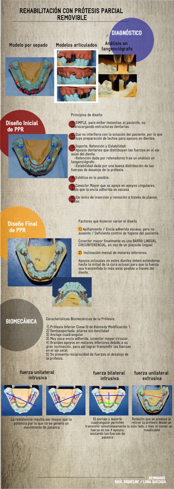 McCracken PROTESIS PARCIAL REMOVIBLE 11 Edicion.pdf