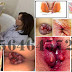 Obat Kapsul Wasir Alami Terbukti Manjur thumbnail