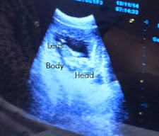 11-11-14 Ultrasound