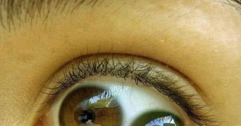 double pupil eye double pupil eye