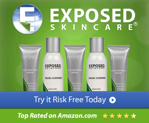 order exposed skin care cheap