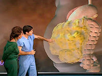 Dr. Oz Oprah Winfrey Greater omentum