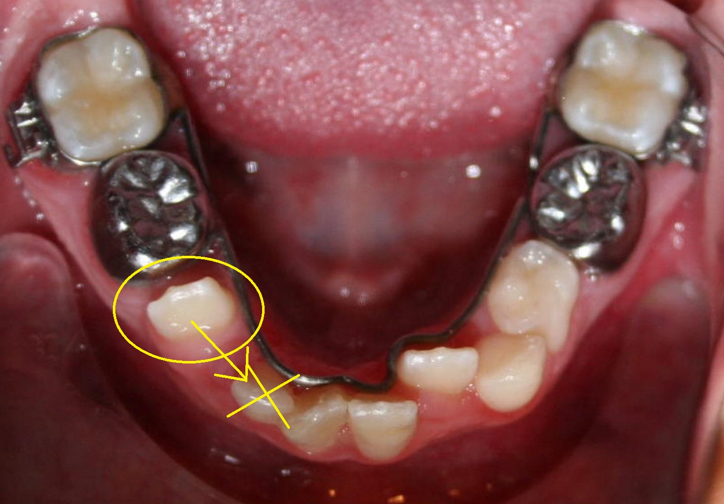 Avery Orthodontics The Art, Science and Excitement of Orthodontic