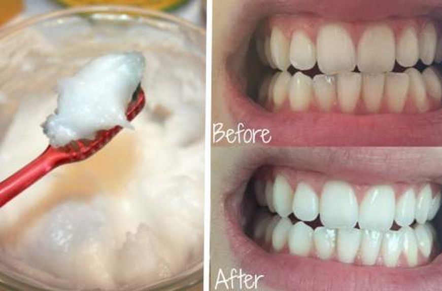 A New Study Reveals That COCONUT OIL Is Far More Beneficial Than The