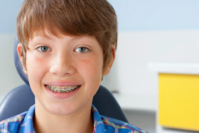 Selecting An Orthodontist