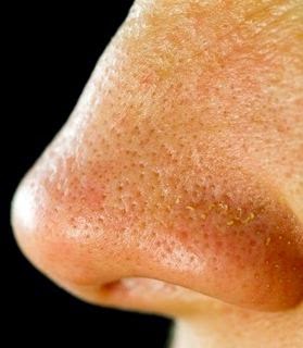 how to reduce nose pore size reducing size of pores