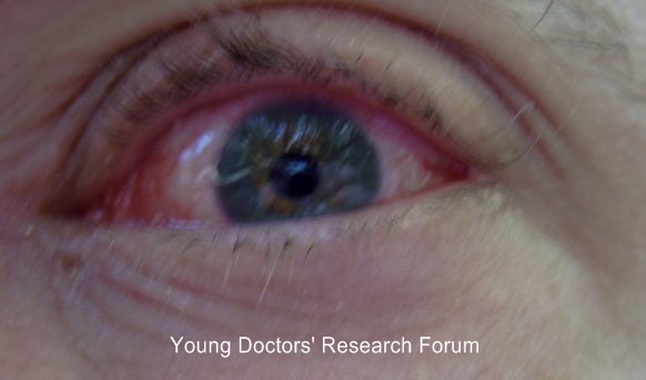 Purulent surgery essays 04 image