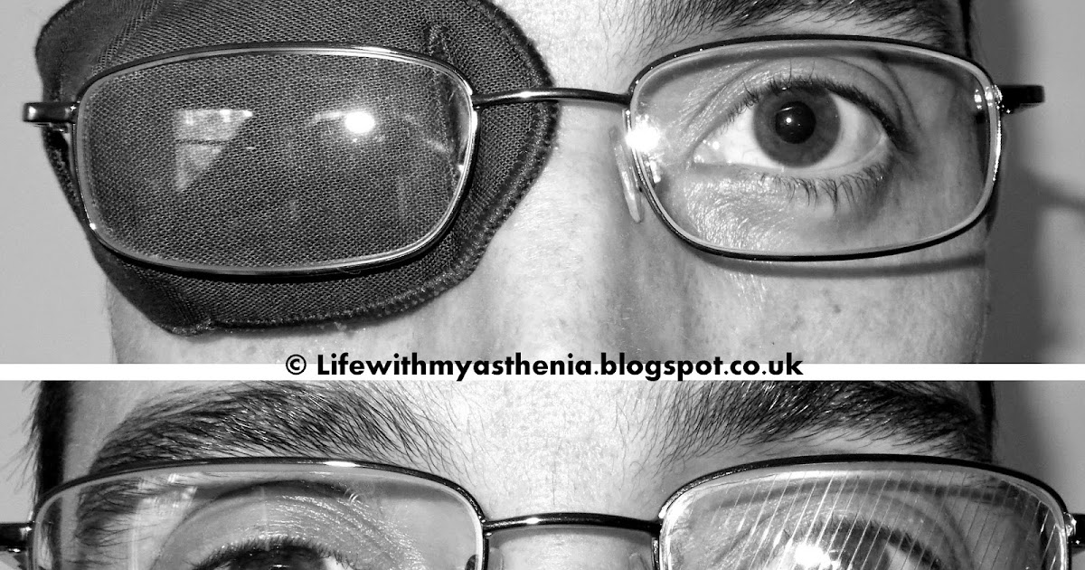 Life with Myasthenia From eye patch to prisms