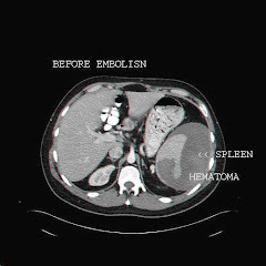 Splenic System