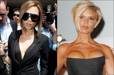 Victoria Beckham Breast Implants Before & After