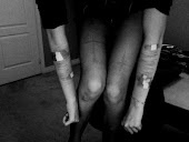 Don't hate  your scars, they're the proof of the unholy battles inside yourself.