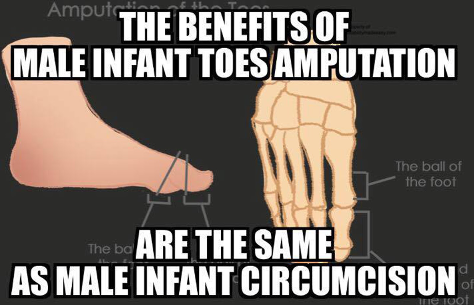 Saving Our Sons Routine Infant Toe Removal Has Health Benefits