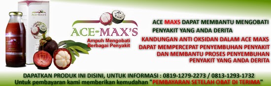 Banner-Ace-Maxs-Artikel.jpg
