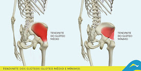 Tratamento de dores e doenças articulares