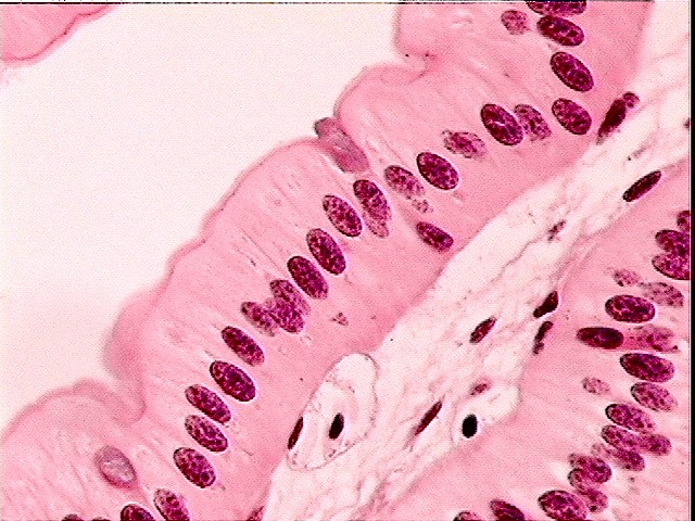 Anatomy and Physiology I Coursework: Epithelial Tissues