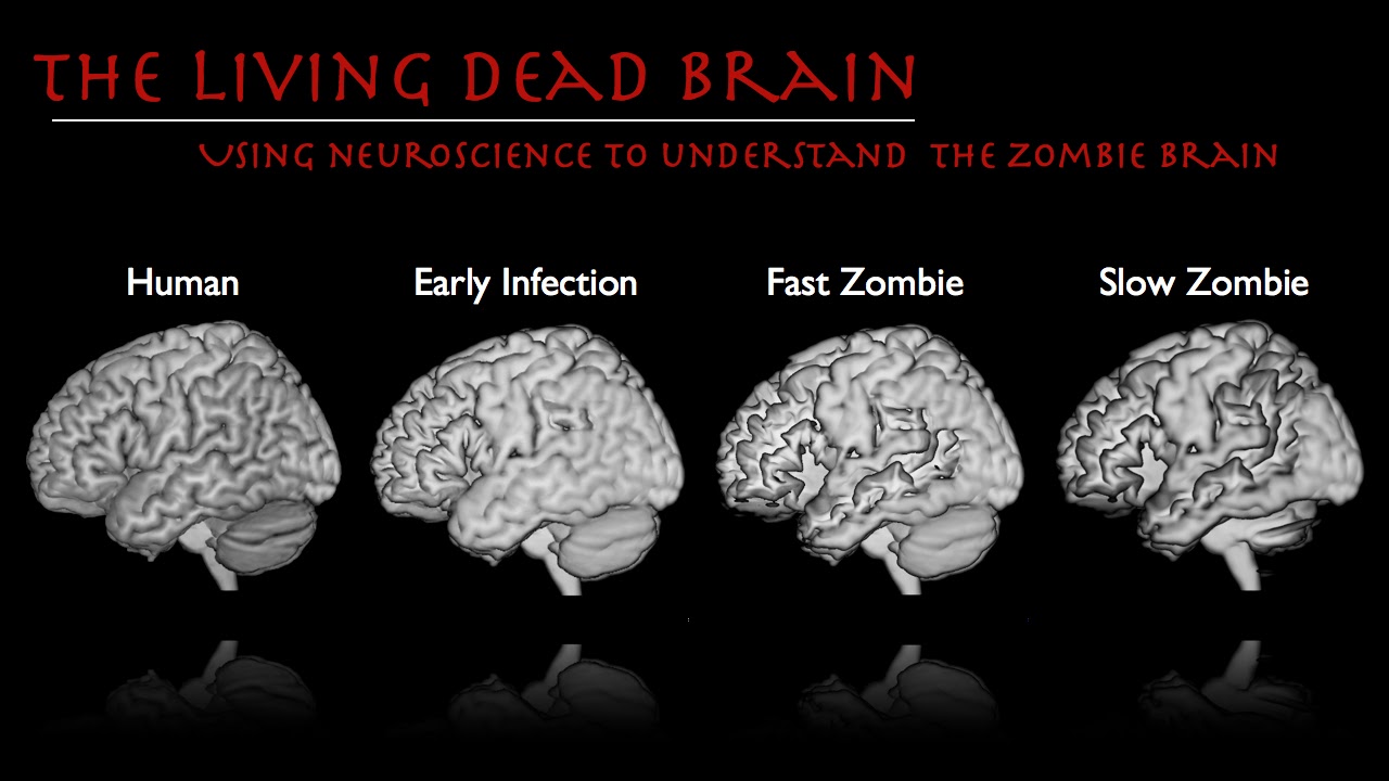 The Cognitive Axon How to make a zombie brain