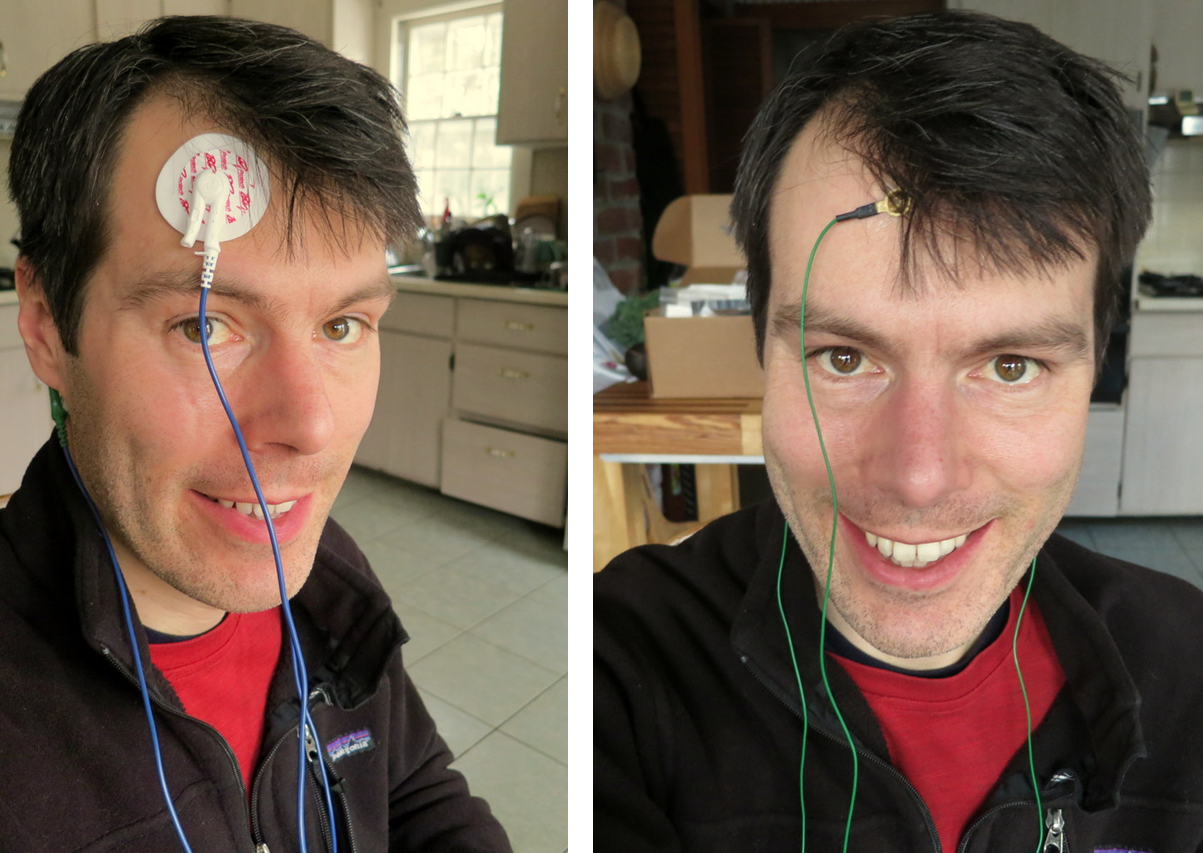 EEG Hacker Impedance of Electrodes on my Head