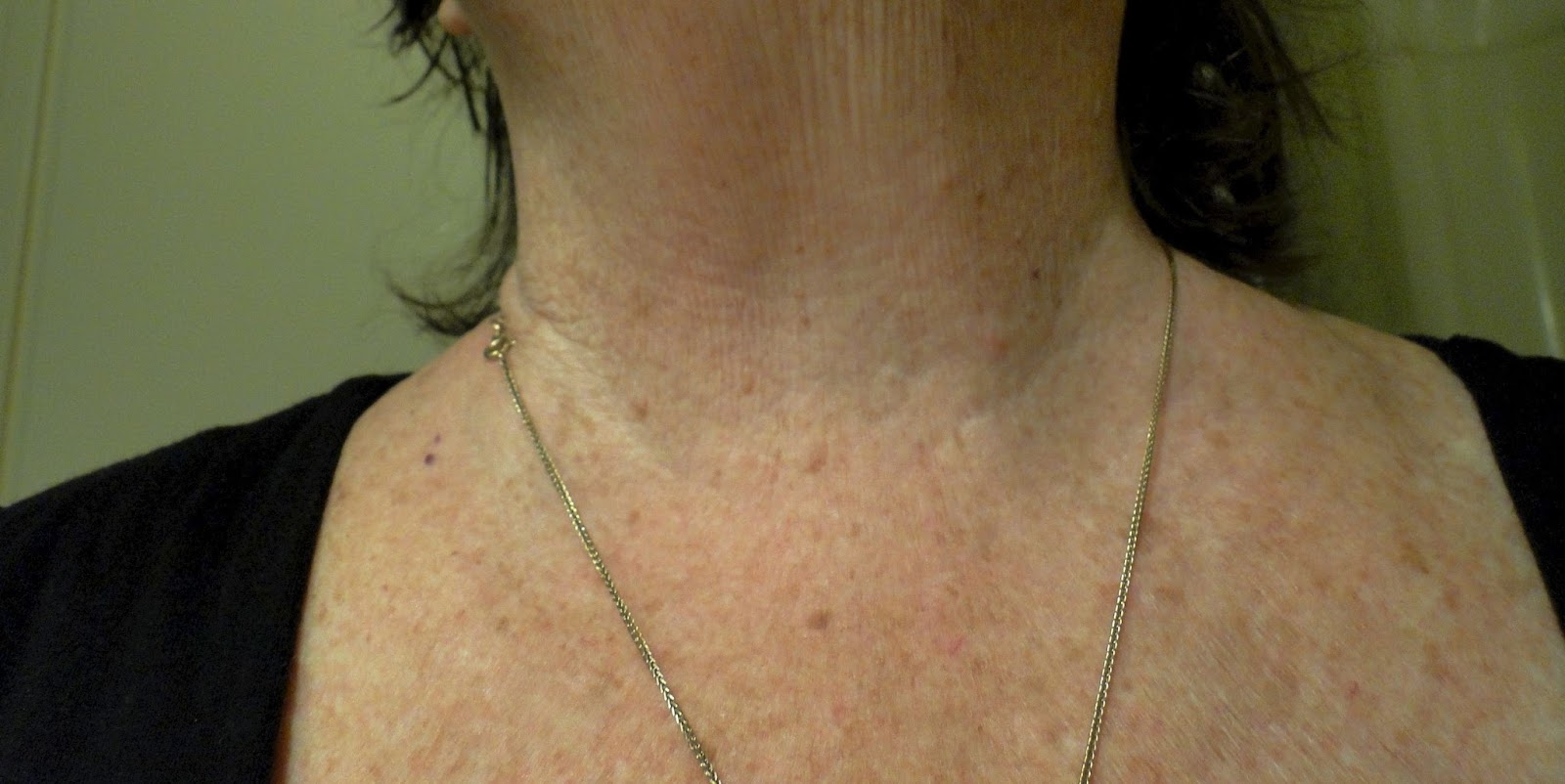 Very Strange Neck Photo ALIEN ABDUCTIONS EFFECTS