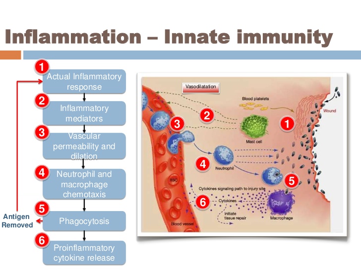 Inflammation.
