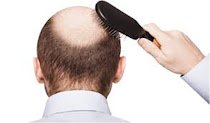 BEST HAIR TRANSPLANT IN INDIA