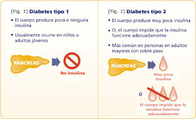 Una mirada a los remedios naturales para la diabetes tipo 1