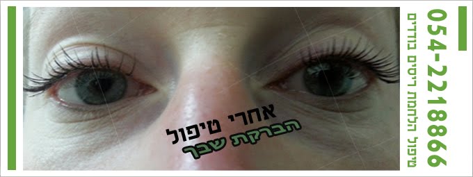 אחרי טיפול אחד