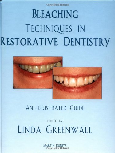Bleaching Techniques Restorative Dentistry 