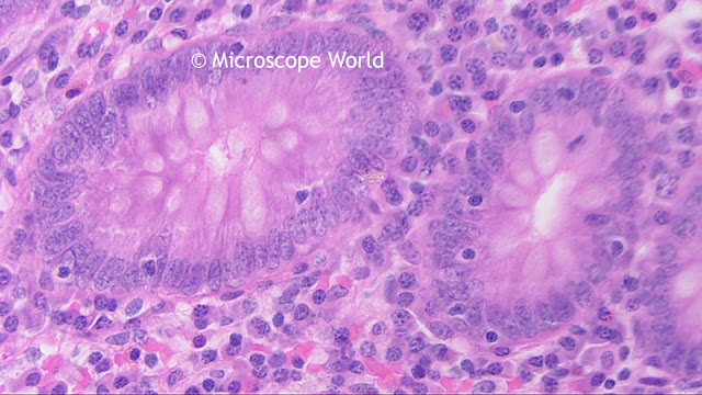 Microscopy image of appendix captured at 400x magnification.