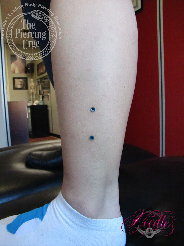 Over 6 Months Old 2 Micro Dermals title=