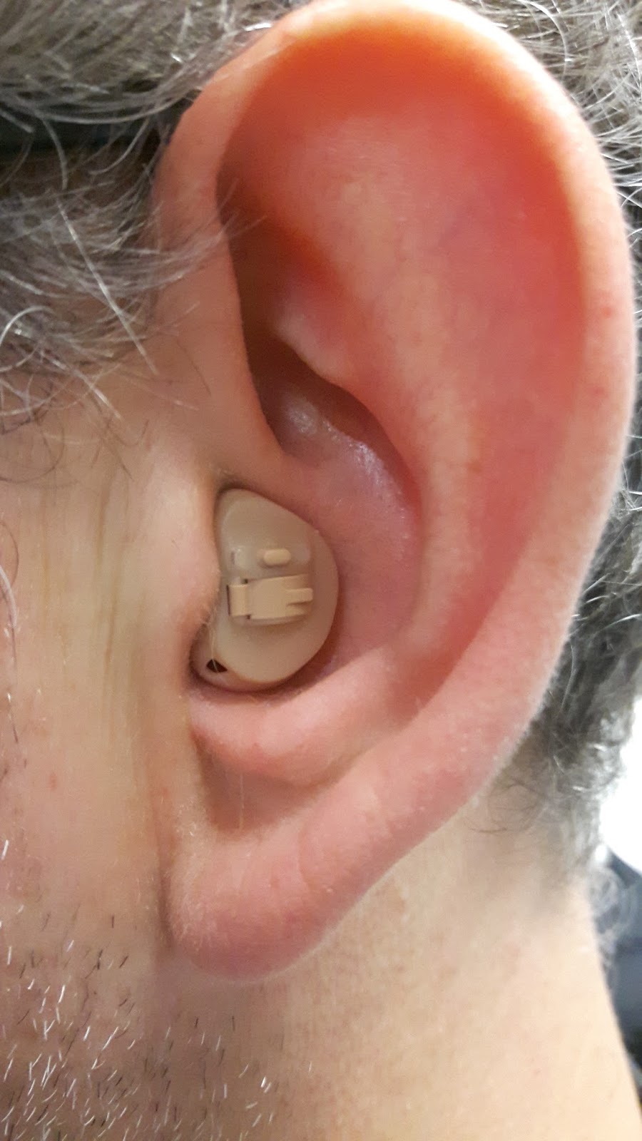 New patient in Leeds moves from ugly hearing aid to a little better