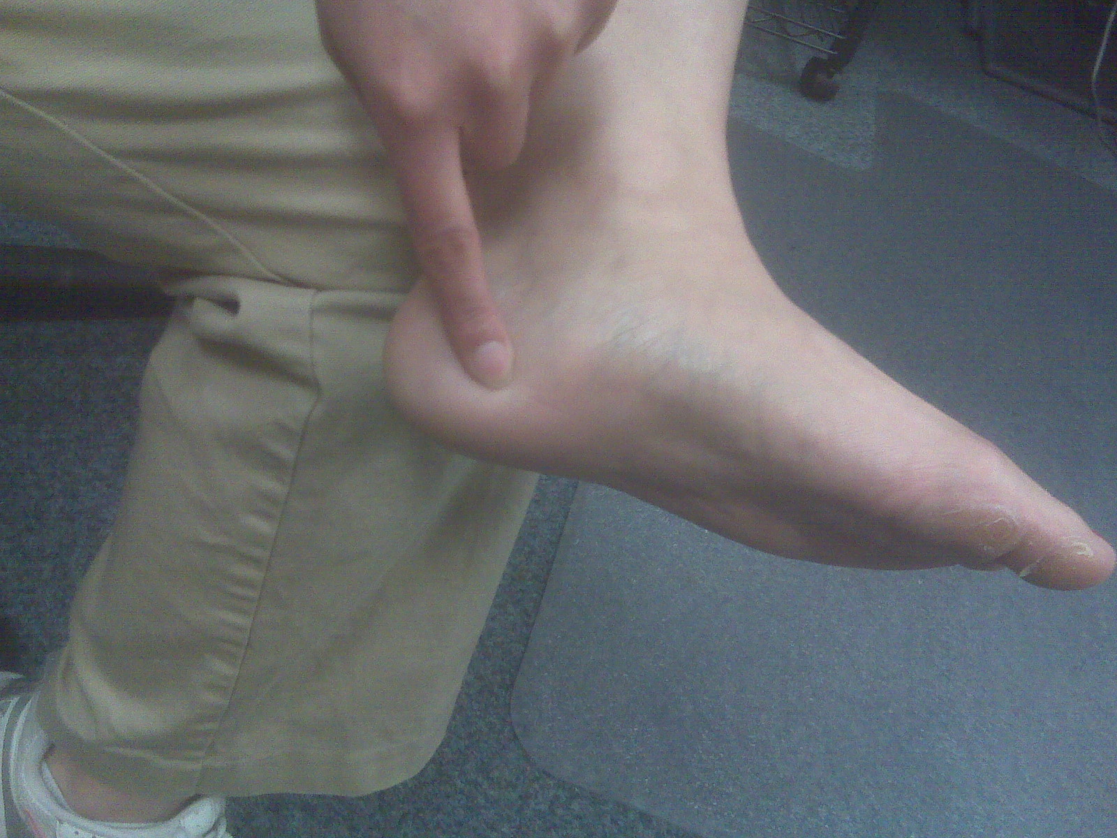 inner foot arch pain inner foot arch pain