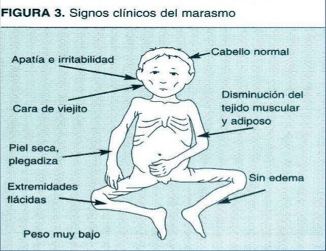 Belita viteks la crema que blanquea